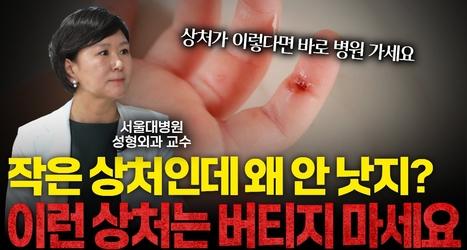 재건성형 명의가 알려주는 방치하면 안 되는 상처 [김상화 서울대병원 성형외과 교수]