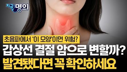 갑상선 결절 암으로 변할까? ‘이 모양’ 발견됐다면 꼭 확인하세요 [유창환 국립암센터 갑상선암센터 교수]