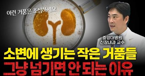 소변에서 '이런' 거품들이 보인다면? 콩팥이 보내는 경고입니다 [신정호 중앙대병원 신장내과 교수]