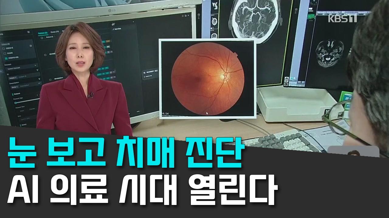 10/31 KBS