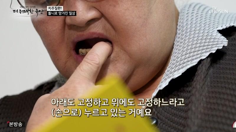 187회